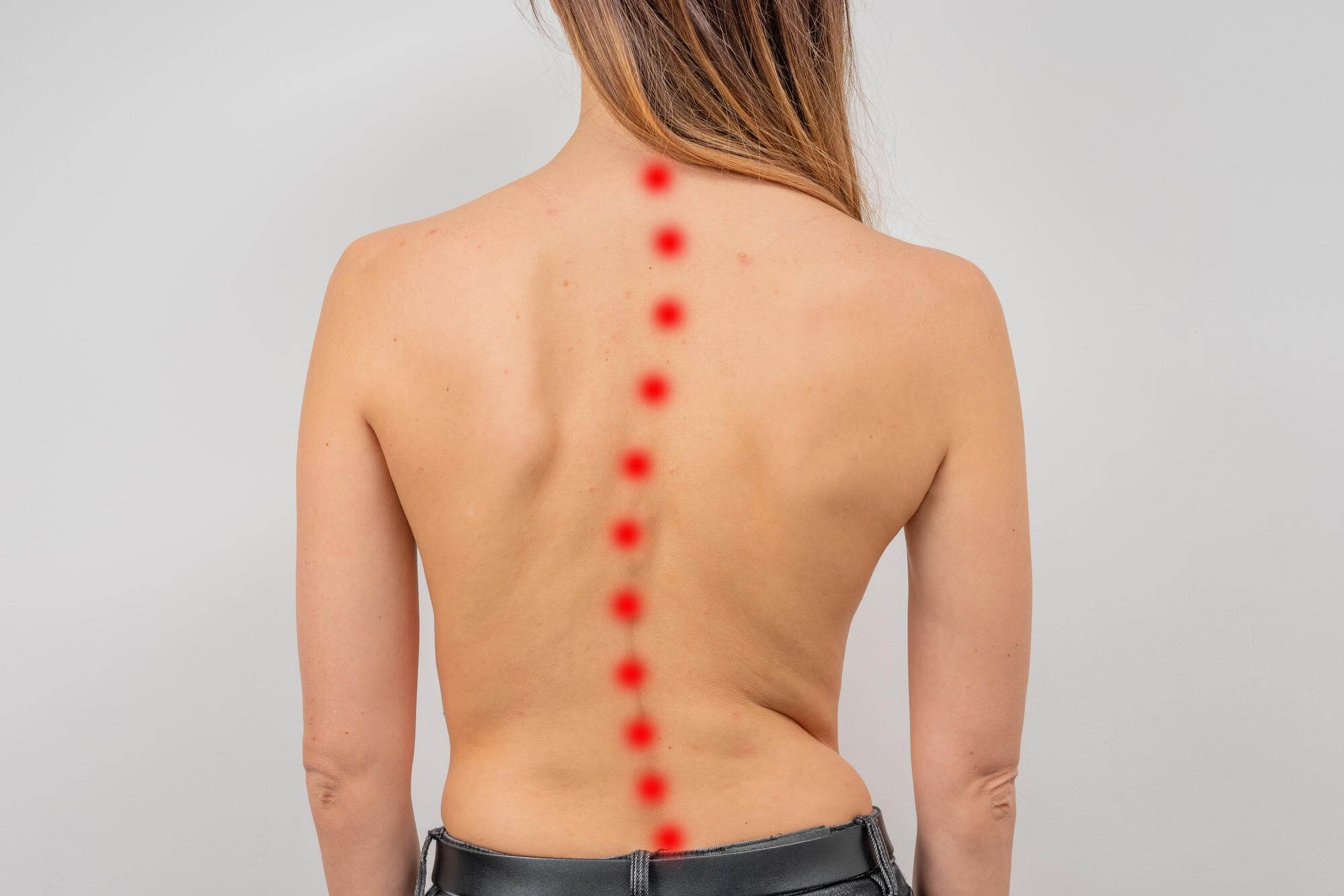 woman-with-scoliosis-spine-curved-woman-s-back-with-acne-skin (1)