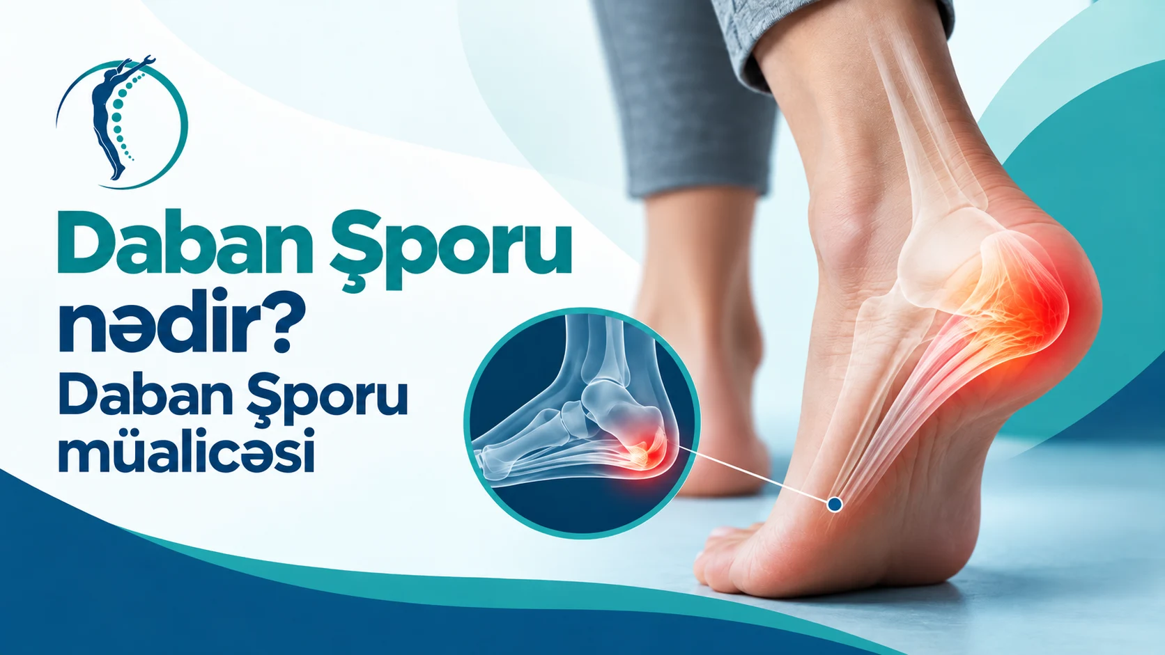daban şporu müalicəsi